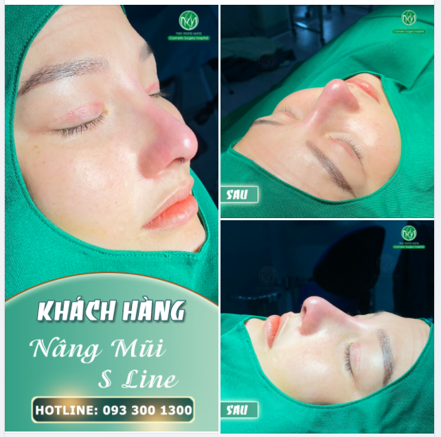 DÁNG MŨI ĐẸP CHO SÁNG CUỐI TUẦN