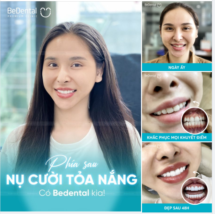 Đằng sau mỗi nụ cười tự tin, tỏa sáng của khách hàng là cả một quá trình dày công đo vẽ, chế tác của đội ngũ bác sĩ Bedental