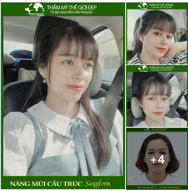 ĐÁNH BẠI COMBO 4 KHUYẾT ĐIỂM MŨI CHỈ TRONG 1 GIẢI PHÁP TẠI SAO KHÔNG