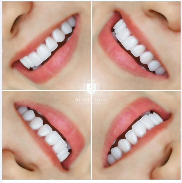 ĐẶT TÂM HUYẾT TRONG TỪNG LỚP MEN SỨ