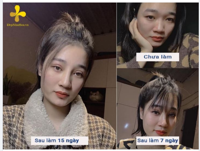 ĐÂU LÀ CHÌA KHOÁ VÀNG” CHO NGŨ QUAN HOÀN HẢO