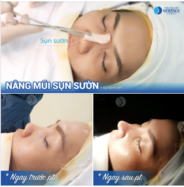 ĐÂY CHÍNH LÀ VẺ ĐẸP “TỰ NHIÊN” KHÔNG TÌ VẾT