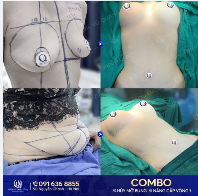 Đẹp là đặc quyền của phụ nữ Đừng ngại thay đổi để có body mơ ước
