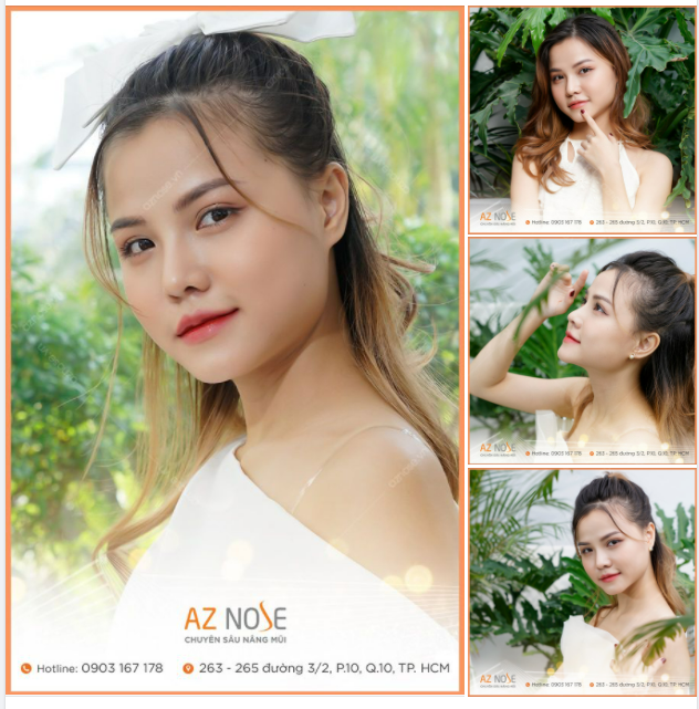 Diện mạo rạng rỡ sau 1 tháng nâng mũi của cô nàng 2K