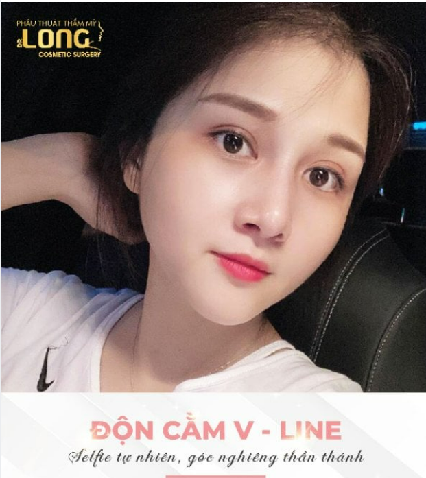 ĐỘN CẰM TẠI PTTM BÁC SĨ LONG, VỚI PHƯƠNG PHÁP SIÊU HIỆN ĐẠI