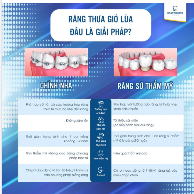 Đóng cửa răng thưa - lựa chọn chỉnh nha hay bọc sứ