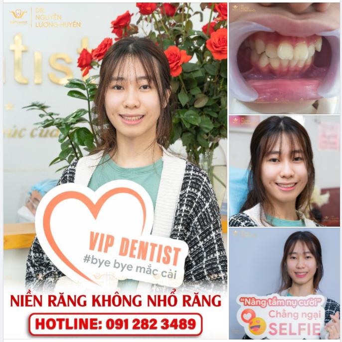 "ĐỒNG NIỀNG" VIP DENTIST VÀ NỖI LO MANG TÊN "SỢ KHÔNG NHẬN RA CHÍNH MÌNH!"