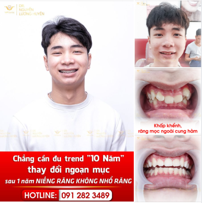 ĐU TREND “10 NĂM THAY ĐỔI” Ư?