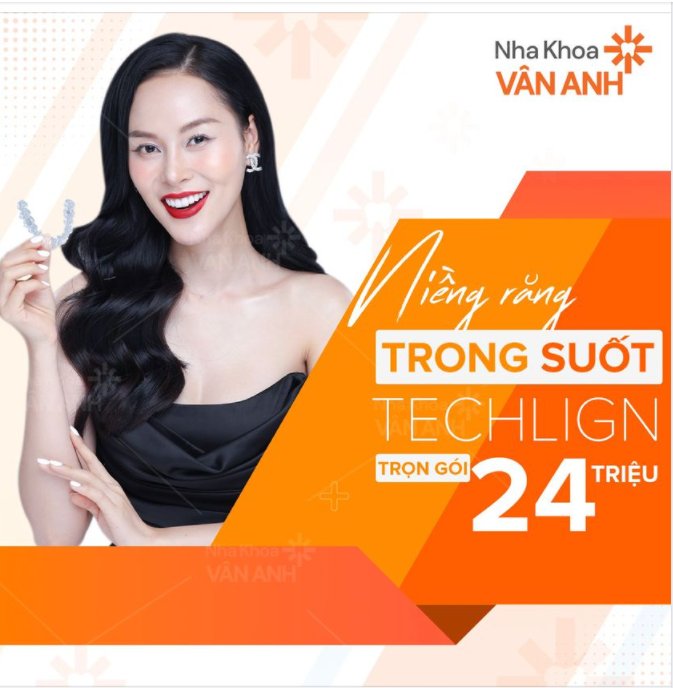 DUY NHẤT THÁNG 4, ƯU ĐÃI NIỀNG RĂNG TRONG SUỐT TRỌN GÓI 24 TRIỆU