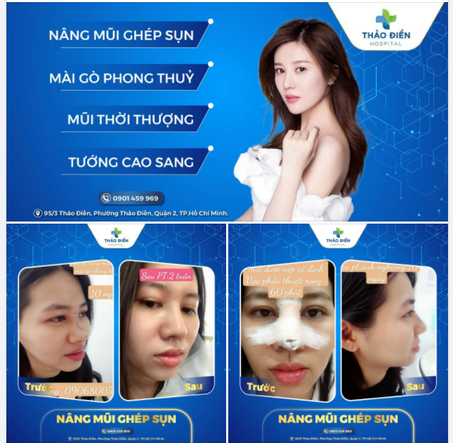 ÉT O ÉT CẢNH BÁO DÁNG MŨI CỰC KÌ “HỊN” DÀNH CHO QUÝ KHÁCH
