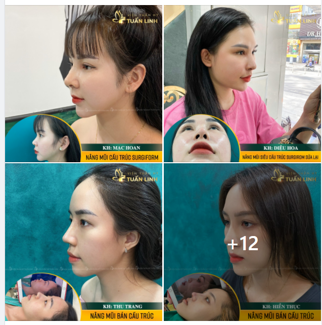 ''ÉT O ÉT NHỮNG CHIẾC MŨI 10 NGÀY TUỔI ''SIÊU PHẨM'' ĐỐN TIM MỌI KHÁCH HÀNG!!!