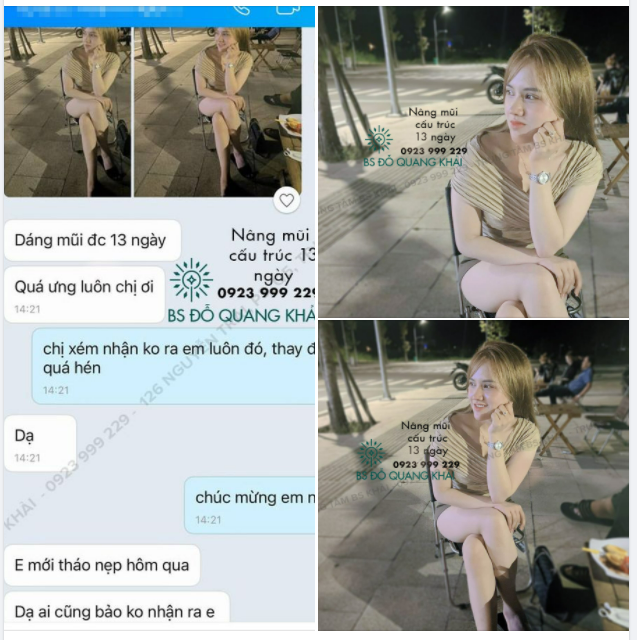 FEEDBACK MŨI CẤU TRÚC 13 NGÀY