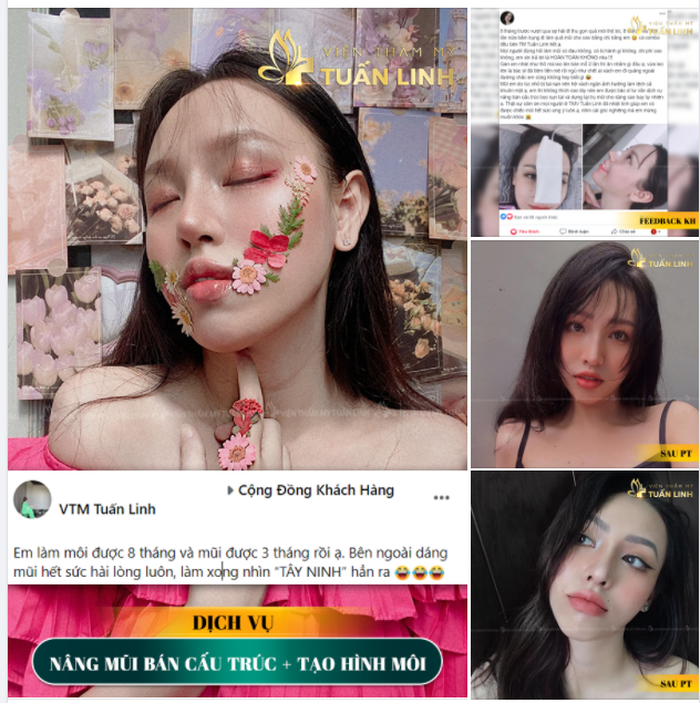 FEEDBACK NÂNG MŨI BÁN CẤU TRÚC + TẠO HÌNH MÔI ĐẸP XUẤT SẮC.