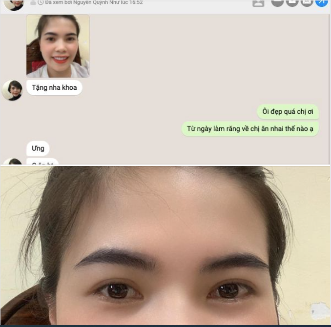 Feedback siêu chất lượng đến từ chị Hương sau 1 năm làm răng sứ tại nha khoa Ngân Phượng 