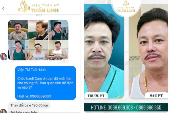 Feedback siêu dễ thương của cô con gái sau khi đưa ba đi nâng mũi