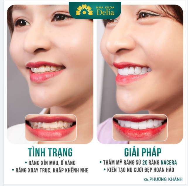 Gắn Kết tình thân bằng nụ cười Hạnh Phúc