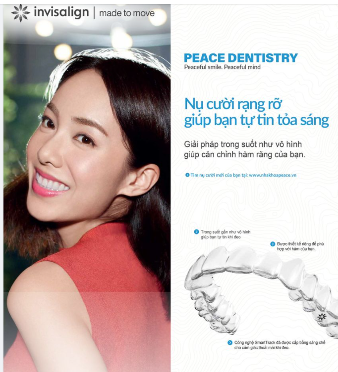 Giải đáp một số câu hỏi thường gặp về chỉnh nha Invisalign?