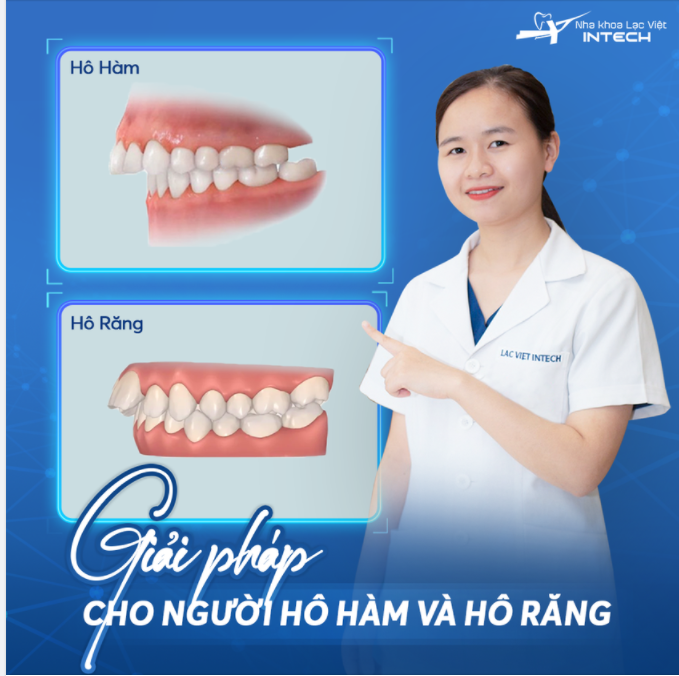 GIẢI PHÁP CHO NGƯỜI HÔ HÀM VÀ HÔ RĂNG