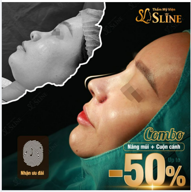 Giảm đến 50% dịch vụ tiểu phẫu. Có tin được không khi mà mọi thứ giá cả đều leo thang