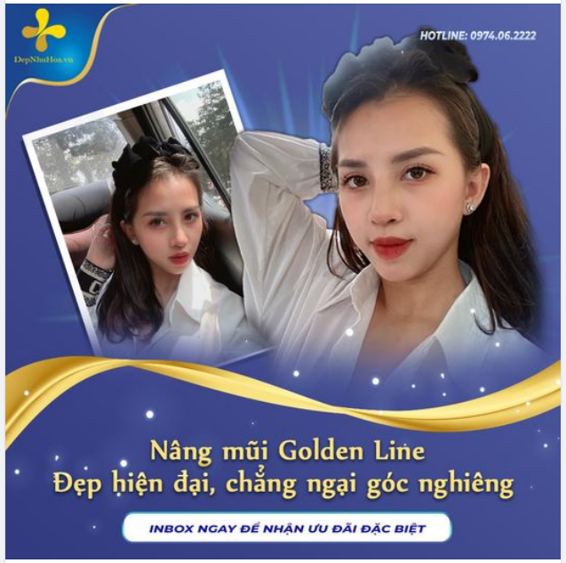 GÓC NGHIÊNG “THẦN THÁNH”- “CHANH SẢ”, LUNG LINH