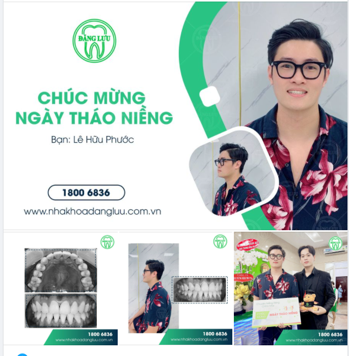 Hàm răng đều đặn -nụ cười rạng rỡ
