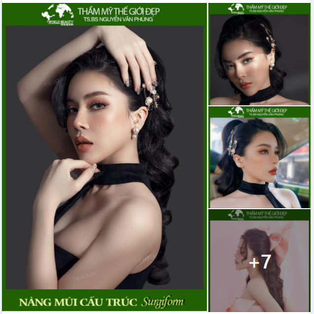 Hành trình đầy gian nan của quý Cô sau 5 lần trùng tu mũi không vừa ý bởi loạt vấn đề