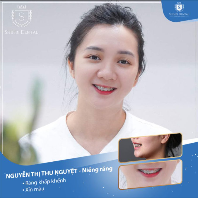 HÀNH TRÌNH TÌM ĐẾN PHIÊN BẢN HOÀN HẢO HƠN CỦA CHÍNH MÌNH
