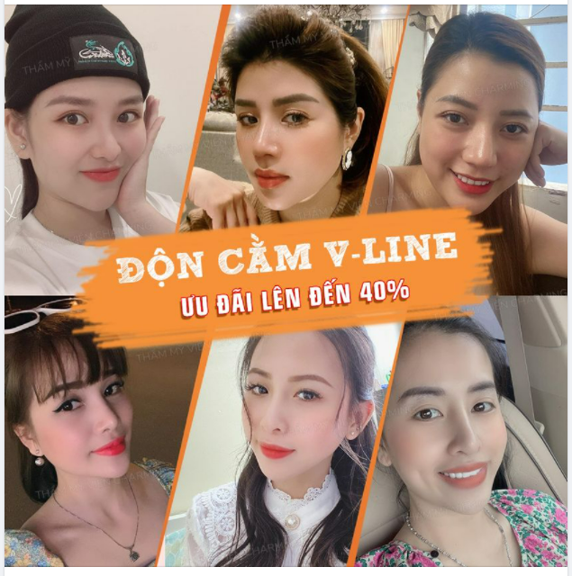 Hãy cùng Charming điểm lại những ảnh feedback độn cằm khiến lòng người ngây ngất nào ​​​​​​​