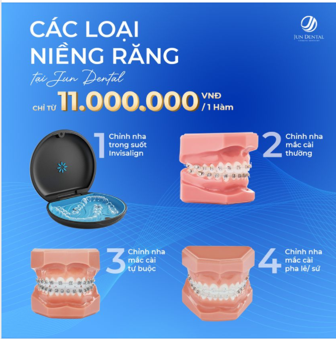 HÈ ĐẾN RỒI, NIỀNG RĂNG THÔI !!!!