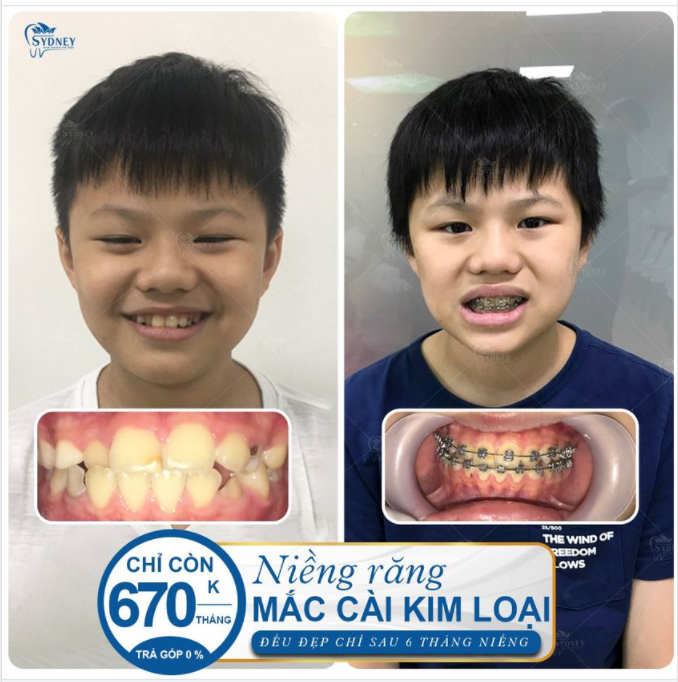 HÈ RỒI  NIỀNG THÔI