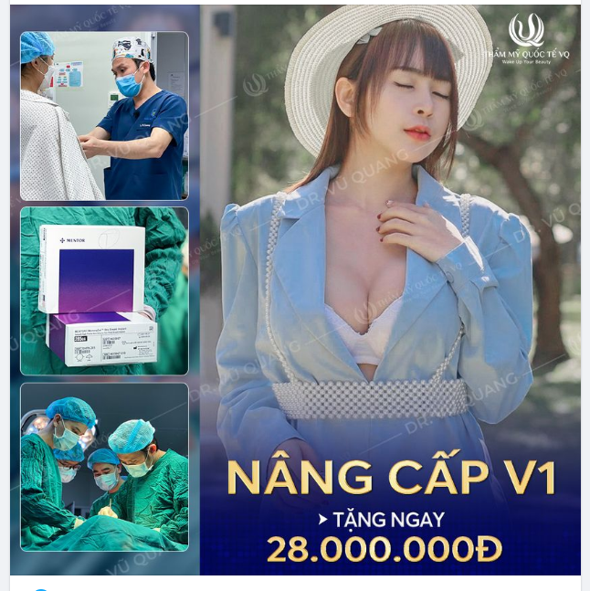 Hết lép , lệch, sa trễ , - V1 căng tròn - NHẬN NGAY 28TR