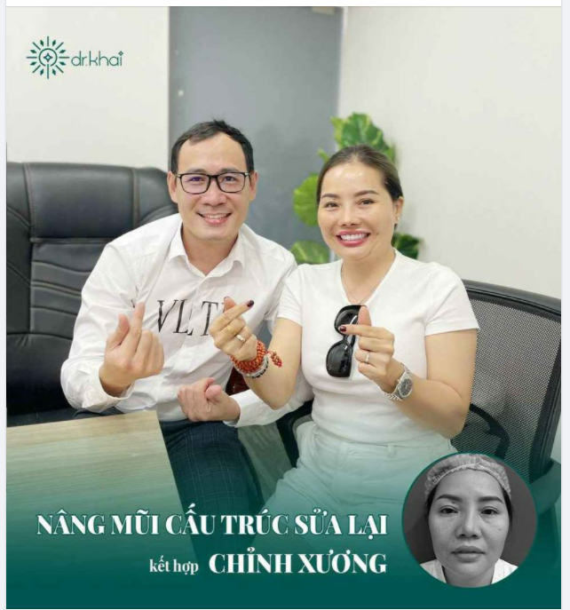 HỘI NGỘ NHÂN BỘI NIỀM VUI SAU NÂNG MŨI CẤU TRÚC SỬA LẠI KẾT HỢP CHỈNH XƯƠNG