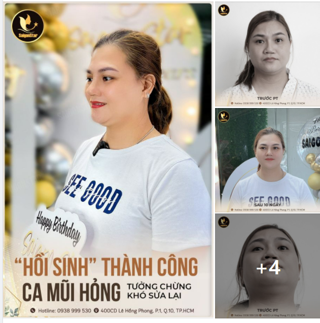 HỒI SINH THÀNH CÔNG CA MŨI HỎNG TƯỞNG CHỪNG KHÓ SỬA LẠI