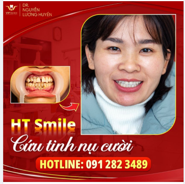 HT SMILE - GIẢI CỨU NỤ CƯỜI