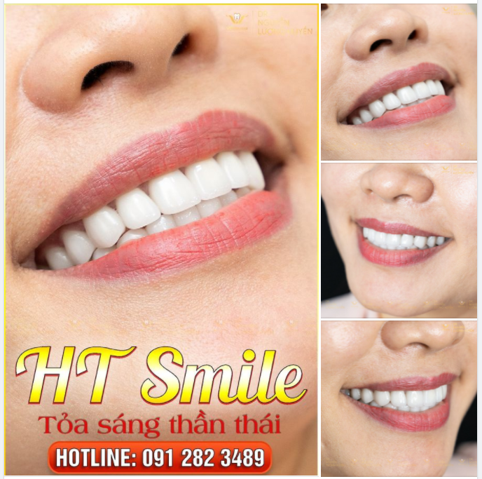 HT SMILE - TỎA SÁNG THẦN THÁI