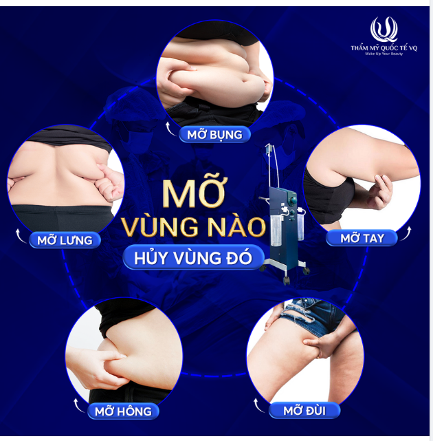 Hủy mỡ 90P bằng ĐI TẬP 10 NĂM