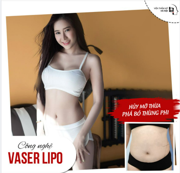 HỦY MỠ THỪA - PHÁ BỎ THUỲNH PHI