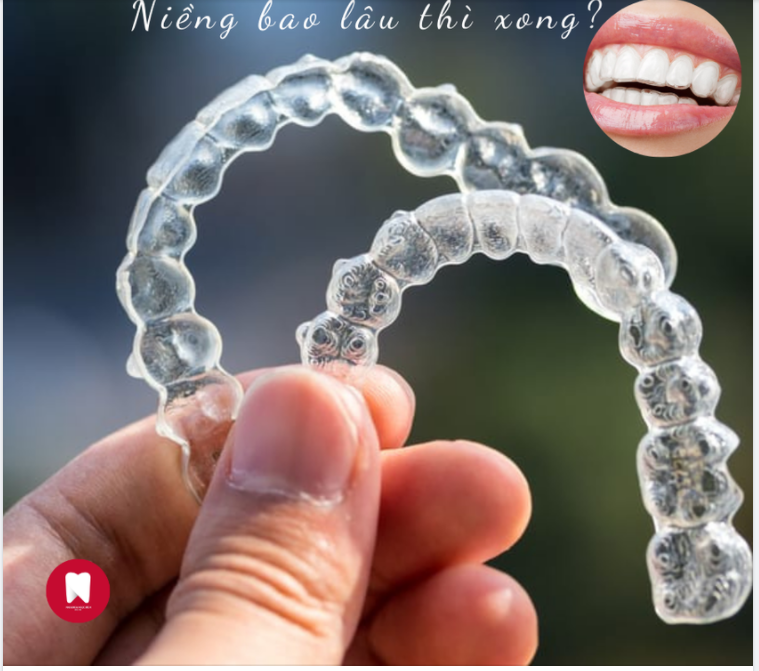 INVISALIGN  NIỀNG BAO LÂU THÌ XONG