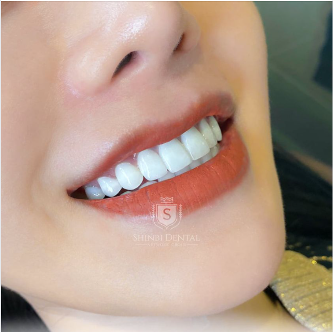 KHOÁC LÊN ÁO TRẮNG TINH KHÔI ĐỂ NỤ CƯỜI ĐẸP MÃI