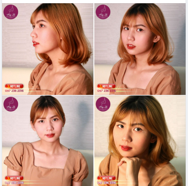 KHOE DÁNG MŨI TỰ NHIÊN LÀM NHƯ KHÔNG LÀM