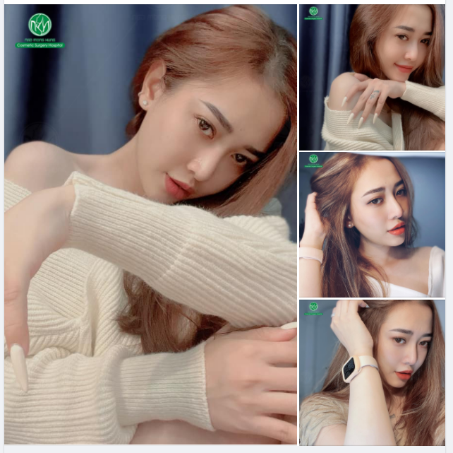 KHOE TRỌN NÉT XINH SAU NÂNG MŨI
