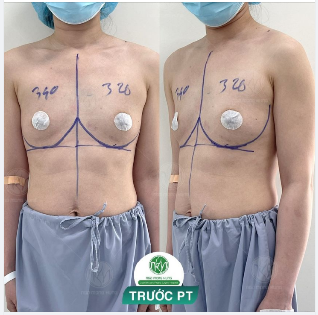 KHỞI ĐỘNG BUỔI SÁNG VỚI CA NÂNG NGỰC