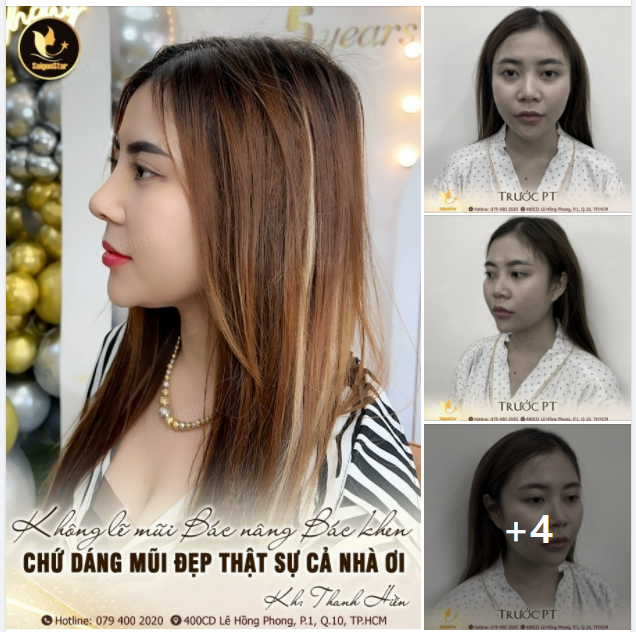 KHÔNG LẼ MŨI BÁC NÂNG BÁC KHEN, CHỨ DÁNG MŨI ĐẸP THẬT SỰ CẢ NHÀ ƠI