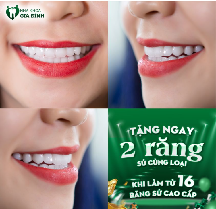 KHÔNG MUỐN CHỜ NỮA. ĐẸP THẾ NÀY PHẢI LÀM NGAY THÔI!!!