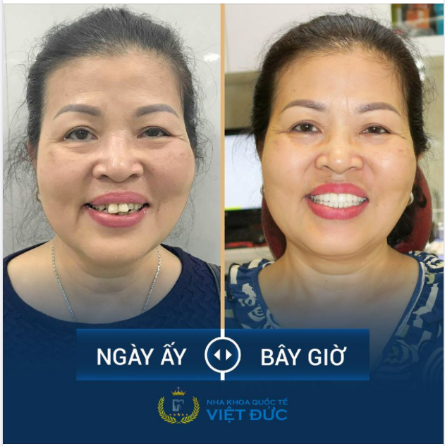 LÀ PHỤ NỮ, Ở ĐỘ TUỔI NÀO CŨNG CẦN PHẢI ĐẸP