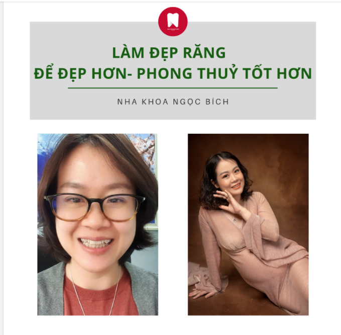 LÀM ĐẸP RĂNG ĐỂ  ĐẸP HƠN - PHONG THUỶ HƠN!