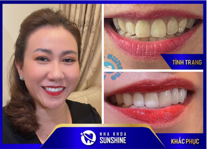 LÀM MỘT LẦN – ĐẸP TRỌN ĐỜI
