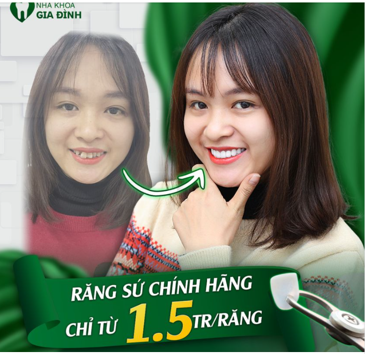 LÀM RĂNG ĐÃ ĐẸP CÒN PHẢI AN TOÀN NỮA!!!