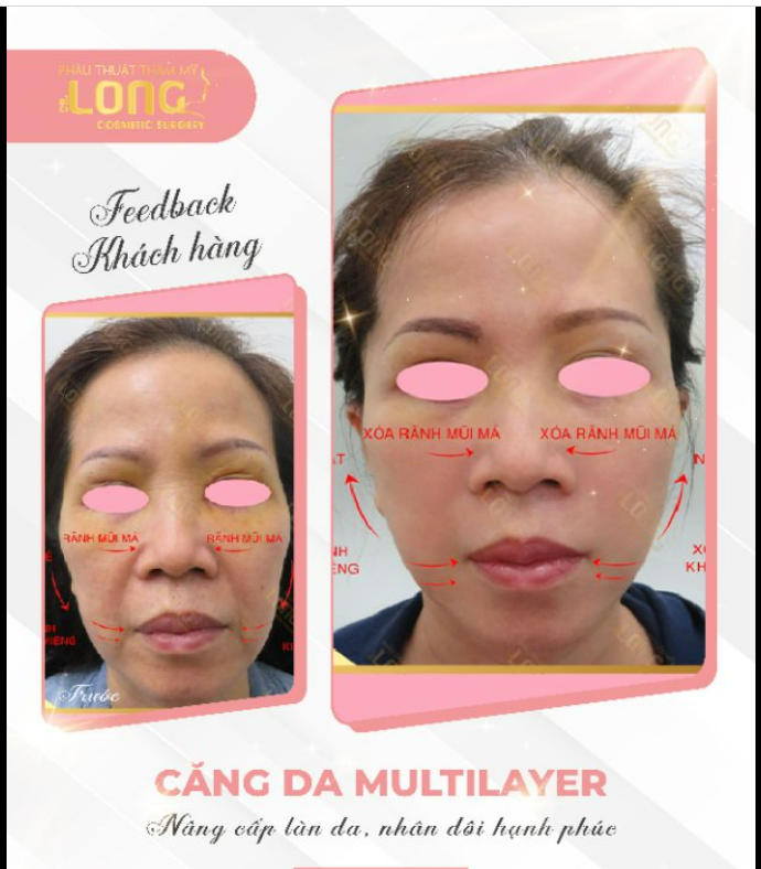 LÀM THẾ NÀO HỒI XUÂN LÀN DA TUỔI TỨ TUẦN  60 PHÚT ĐÁNH THỨC LÀN DA