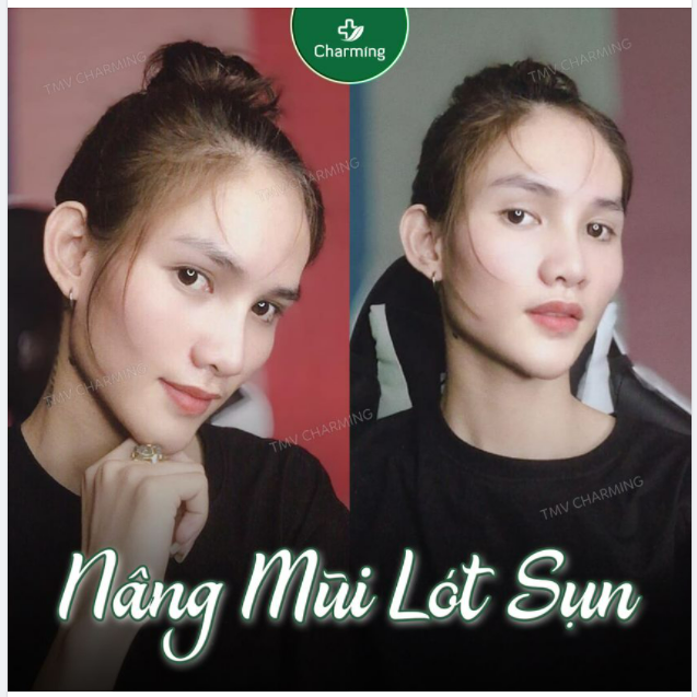 Lâu lâu bác Khanh chiều khách bọc megaderm một lần mà cũng rất gì và này nọ lắm chứ bộ